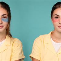 BEAUTY ROUTINE PATCH OCCHI